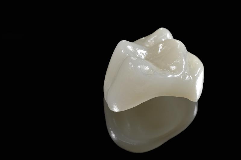 Porcelain dental crowns